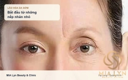 Lão hóa da sớm ở tuổi 20-30: nguyên nhân và cách phòng ngừa