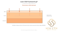 Laser CO2 Fractional là gì?