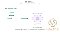 PDRN trị sẹo: hoạt chất sinh học hỗ trợ tái tạo da