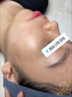 Routine chăm sóc da mụn sáng và tối: các bước chuẩn cần nhớ