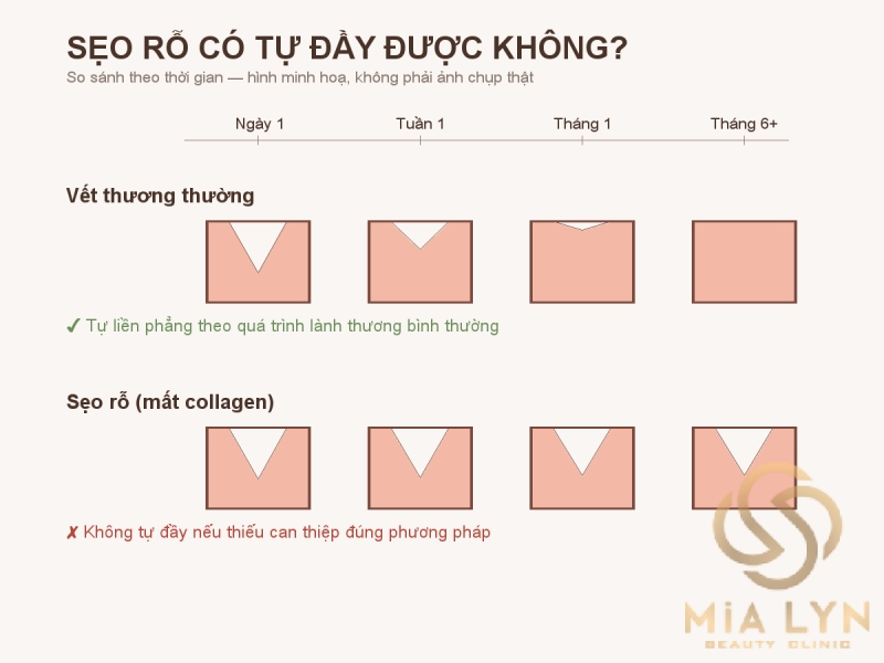 Sẹo rỗ có tự đầy được không?