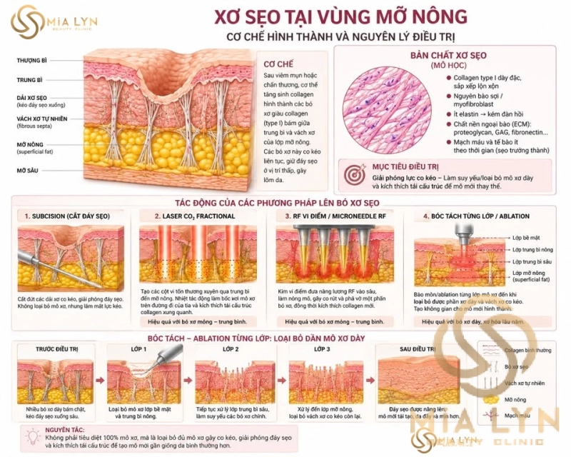 Xơ sẹo là gì? Vì sao trị sẹo rỗ cần xử lý xơ sẹo trước bề mặt da